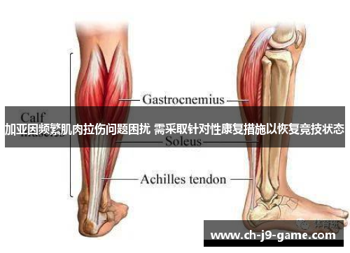 加亚因频繁肌肉拉伤问题困扰 需采取针对性康复措施以恢复竞技状态